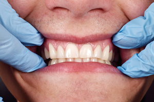 Dentist shows a patient's teeth