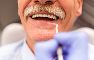 An old man getting his dentures checked at a professional denturist