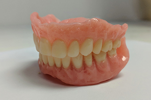 precision-dentures