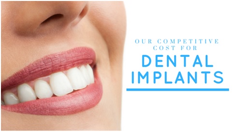 dental implant cost bajic