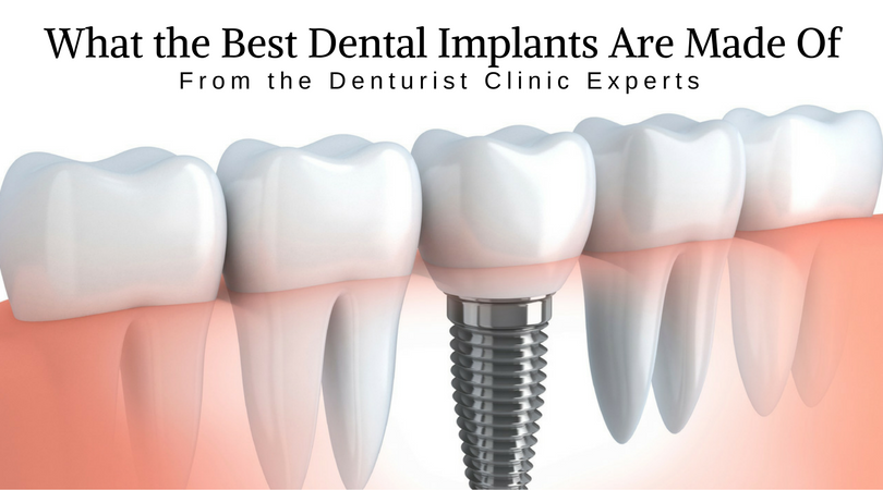 What the Best Dental Implants are Made of image