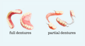 full dentures partial dentures